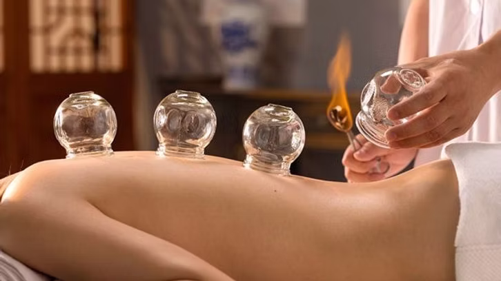 Cupping